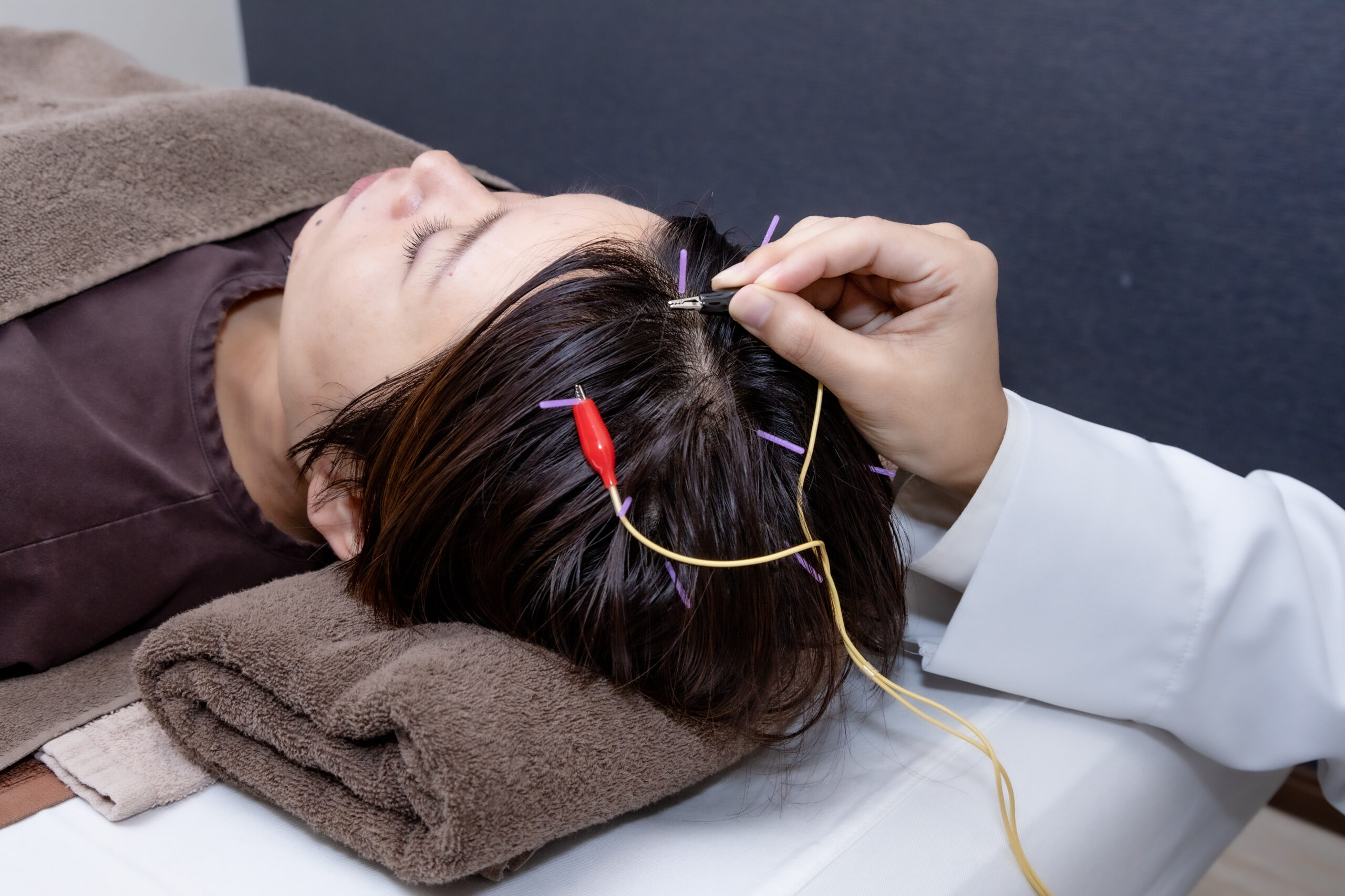 吉祥寺で「ブレインフォグ」による集中力低下・思考力のもやを和らげる鍼灸治療