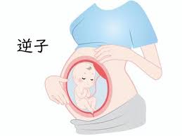 【吉祥寺 逆子 鍼灸】お腹の赤ちゃんの位置でお悩みの方へ