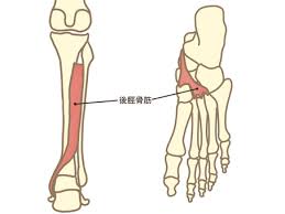 【吉祥寺 後脛骨筋機能不全 鍼灸】大人の偏平足、足首の内側の痛みでお悩みの方へ