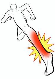 【吉祥寺 アキレス腱炎 鍼灸】歩行時の痛み、ランニングの不調、踵の腫れでお悩みの方へ