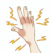 【吉祥寺 手・手指のしびれ 鍼灸】指先から腕にかけてのしびれ、原因不明の症状でお悩みの方へ