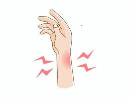 【吉祥寺 腱鞘炎 鍼灸】手首・指の痛み、ドケルバン病、ばね指でお悩みの方へ