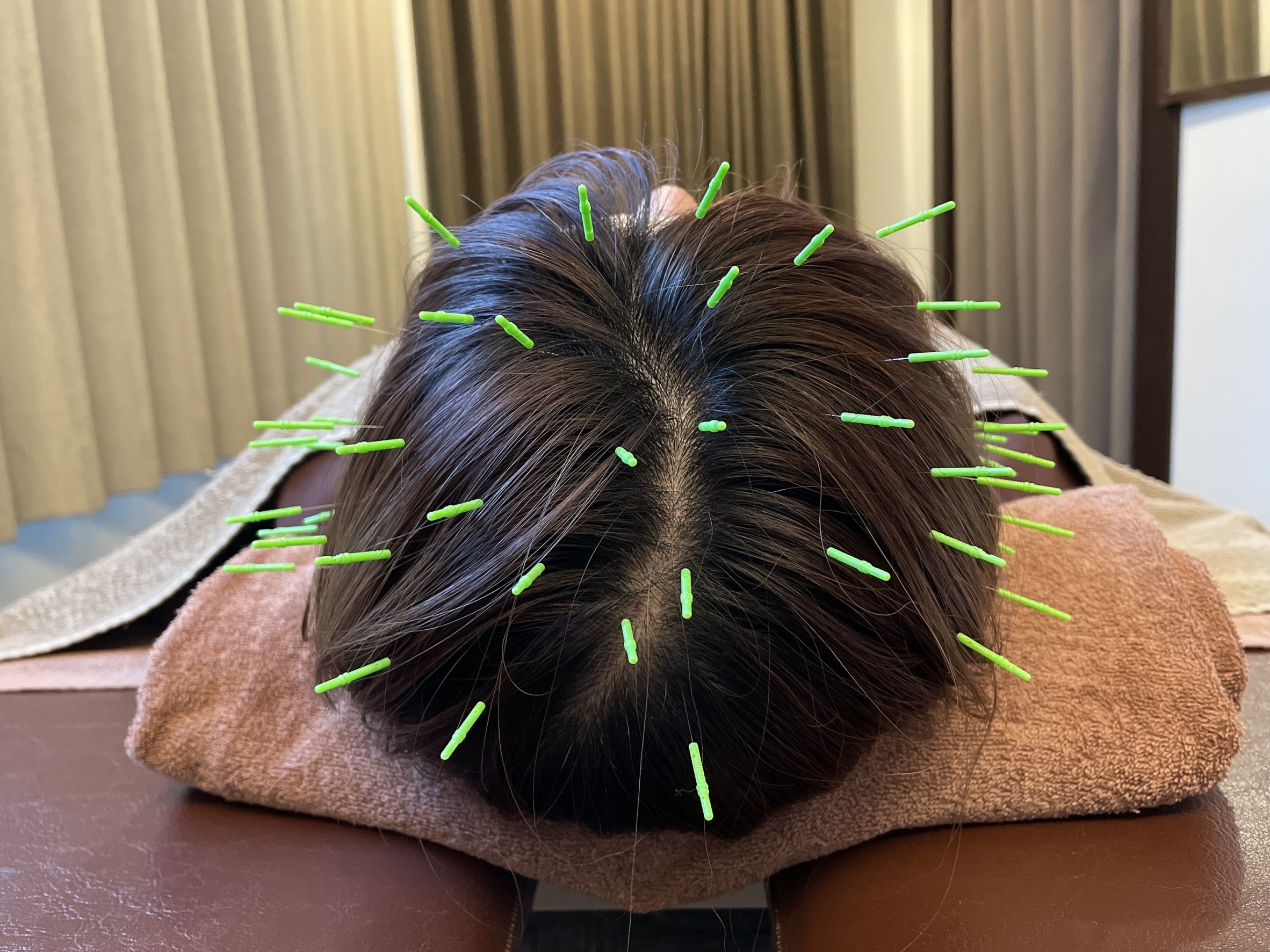 【吉祥寺 睡眠障害 鍼灸】不眠、寝つきの悪さ、中途覚醒でお悩みの方へ